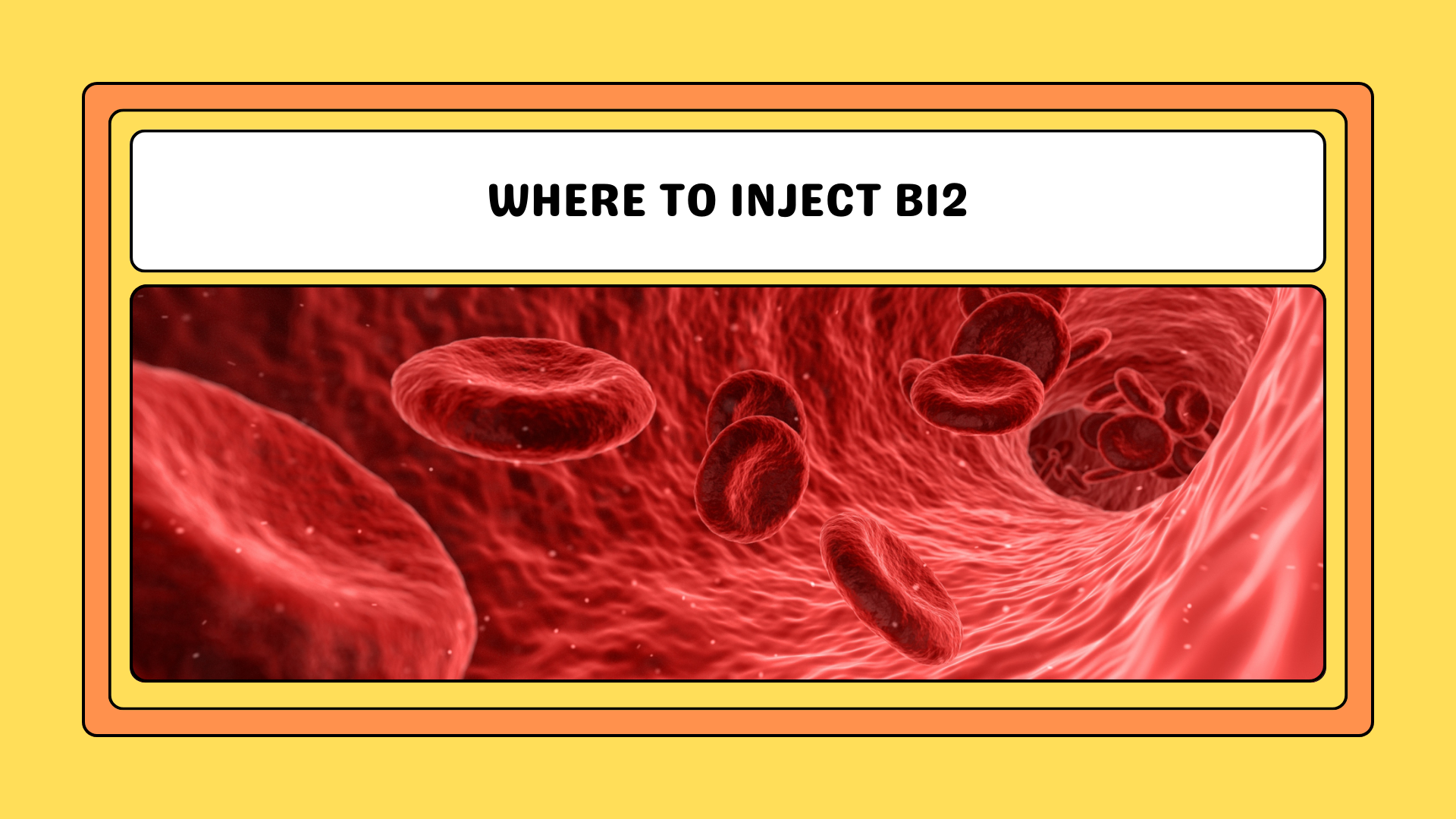 Where to Inject B12